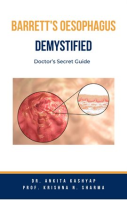 Barretts_Oesophagus_Demystified__Doctor_s_Secret_Guide