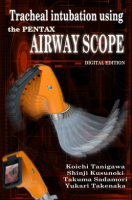 Tracheal_Intubation_Using_the_PENTAX_Airway_Scope